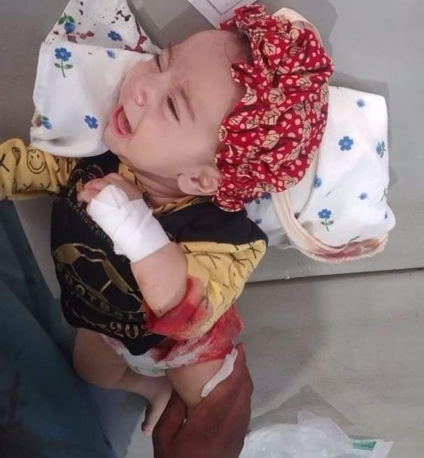 کودک زخمی افغان- Afghan Injured Child
